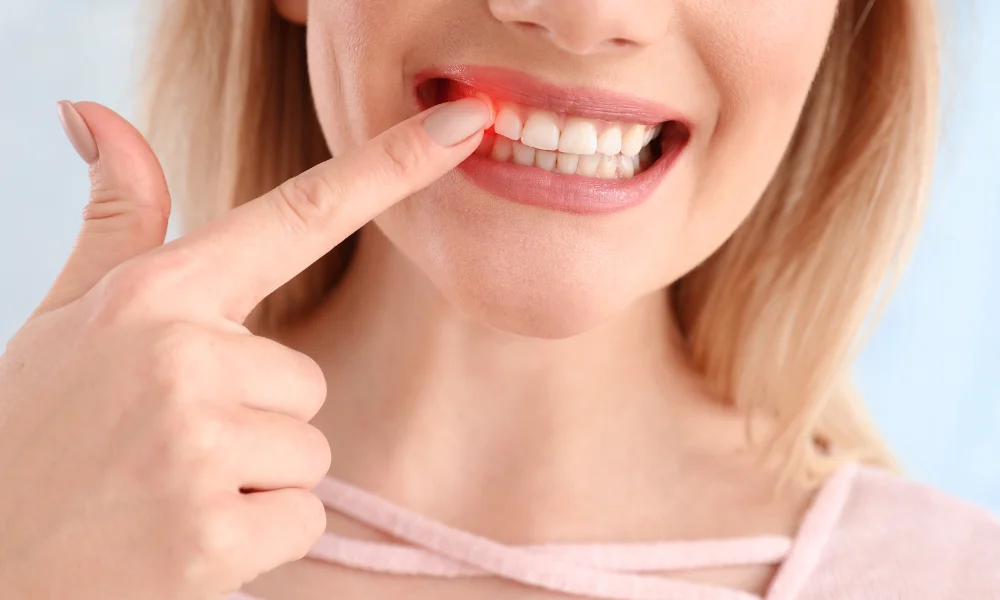 6 Signs and Symptoms of Periodontal Disease