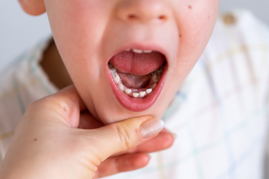 Effective Strategies for Preventing Dental Issues in Kids