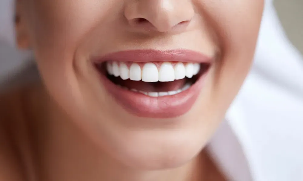 Cosmetic Dentistry: Enhancing Smiles, Changing Perceptions